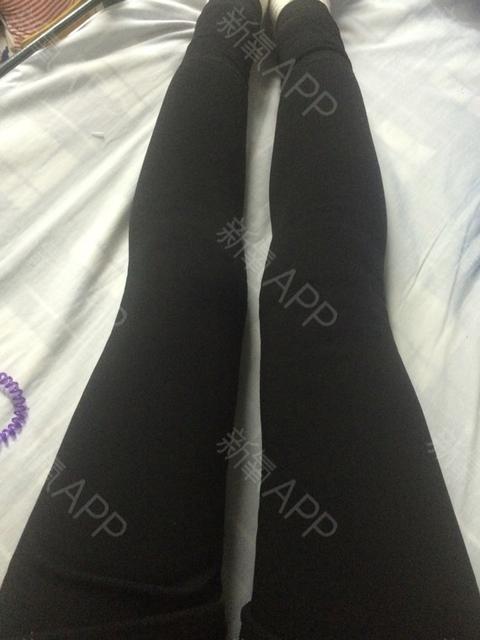 宝宝的腿弯怎么办?