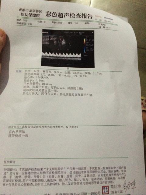 宝宝脐带会存在什么问题