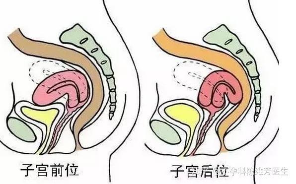 女性怀孕后子宫最大能到孕前的多少倍