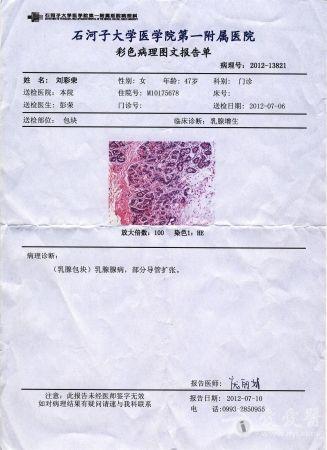 女性乳腺增生能治好吗