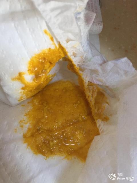 拉出的大便很干很硬怎么办