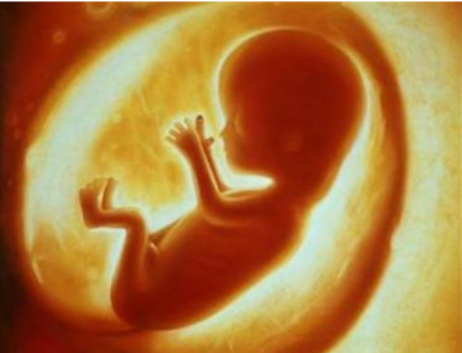 胚胎停育会自然流产吗