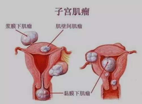怀孕胎位低是什么原因