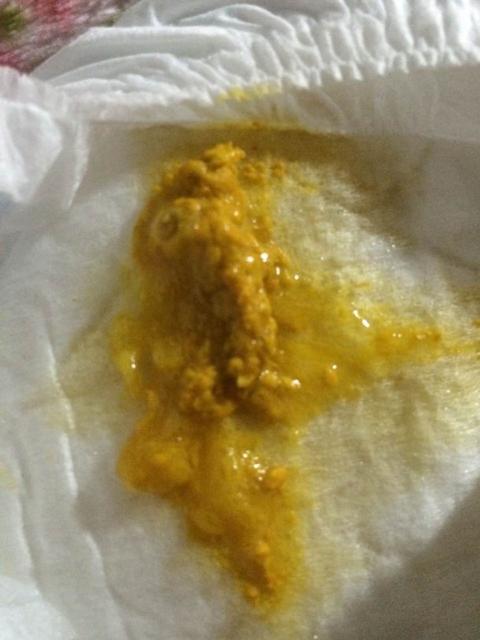 宝宝消化不良怎么办快速解决