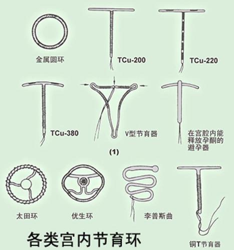 哪种避孕环比较好