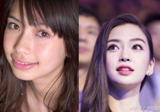 为什么戴牙套3个月了还没有变化