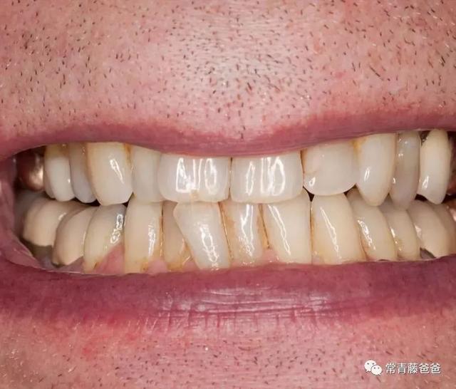 孩子不爱刷牙是什么原因