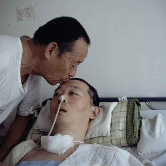 王,35岁,河南人,经营煤炭生意.两年前突发脑溢血,一直昏迷不醒.