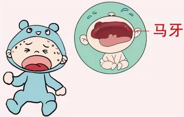 宝宝一出生就有牙齿和马牙有什么关系