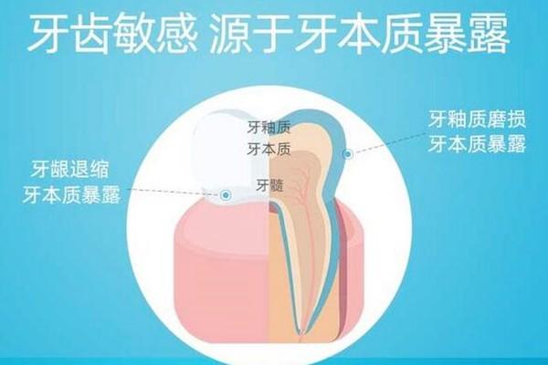 补牙后牙齿敏感是什么原因引起的