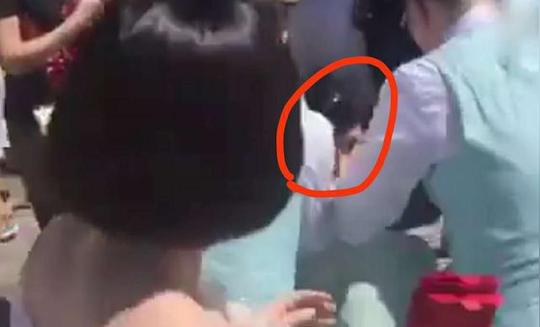 网红拉姆遭前夫泼汽油全身烧伤，只因被评论喊老婆，网友：不自爱