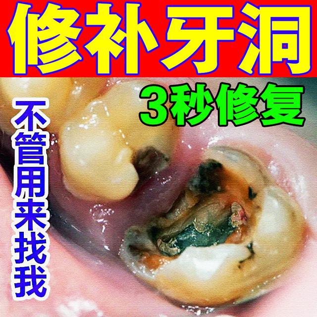 长了蛀牙可以不管吗
