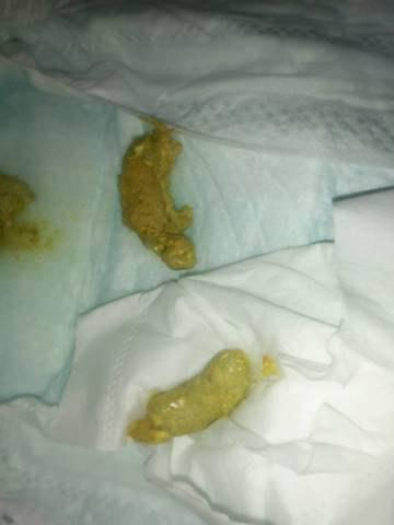 宝宝腹泻还能喝奶粉吗?