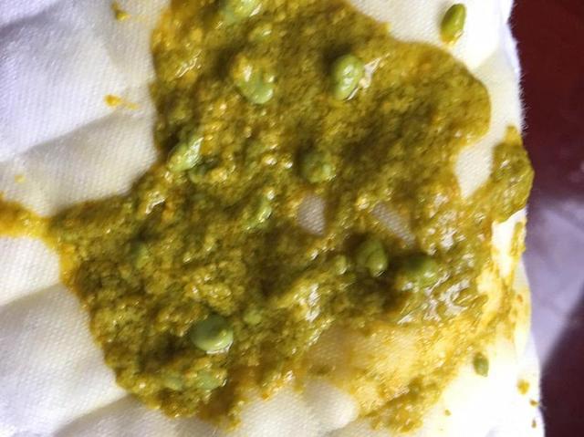 婴儿腹泻奶粉有哪些品牌