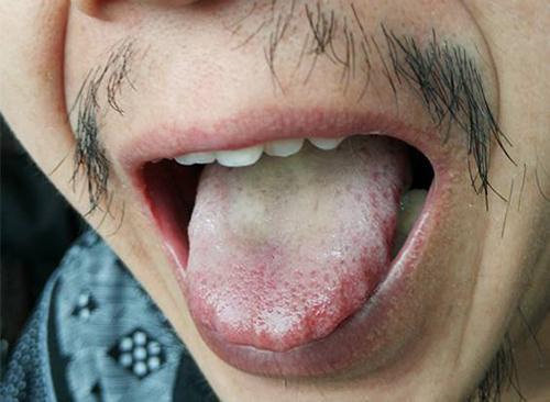 怎么知道孩子体内有湿气