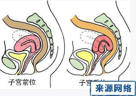 备孕先看子宫好不好