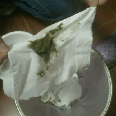 新生儿黄疸怎么退得快一点