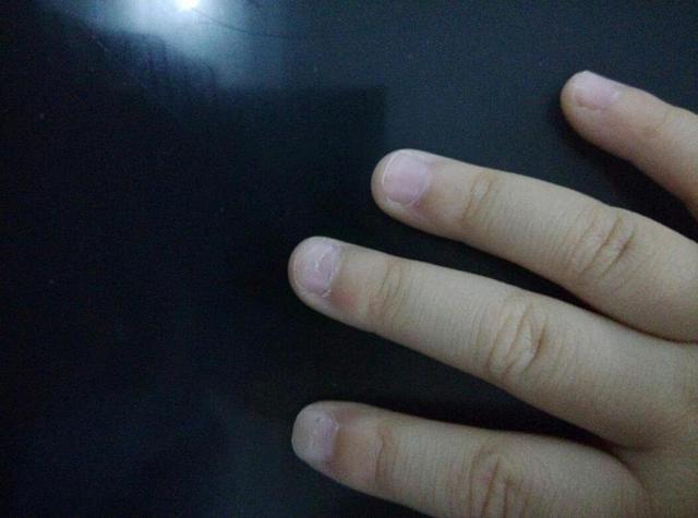 儿童是否缺钙挂什么科