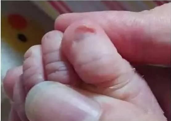 怎么给小宝宝剪指甲,不会伤到手