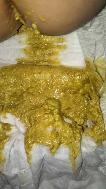 新生儿拉肚子的症状