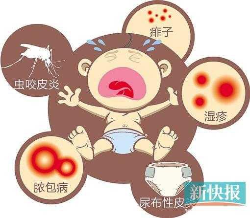 新生儿肚脐防护