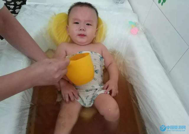 宝宝积食会引起哪些疾病