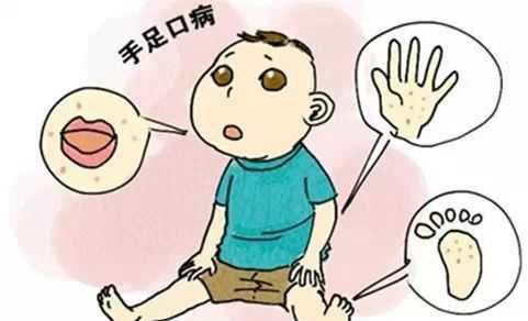孩子得了手足口病要怎么护理