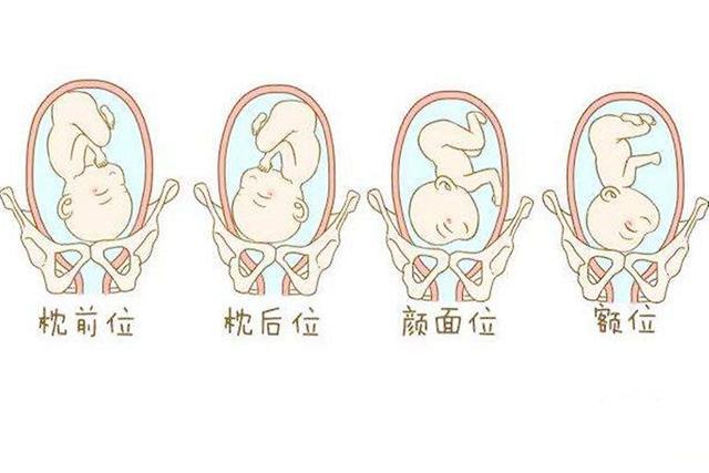 怎么样知道自己能不能顺产