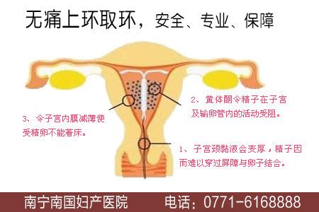 取环后月经不正常是怎么一回事