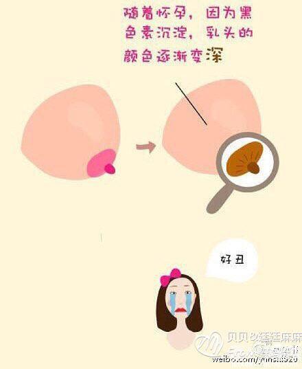 孕期黑色素沉淀什么时候能褪掉