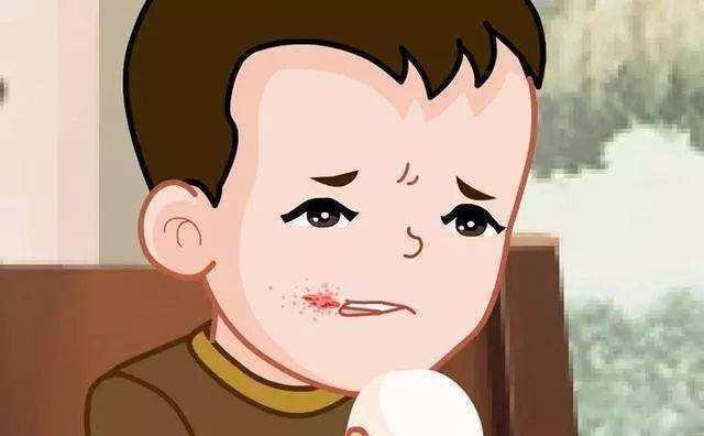 嘴唇干燥起皮需要用润唇膏吗