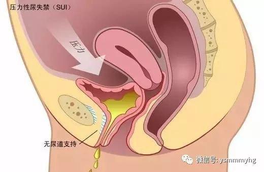 产后第一次出门心情说说