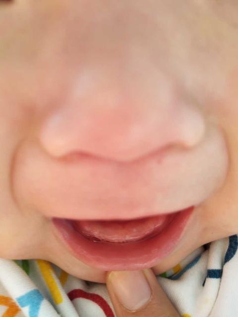 婴儿上乳牙出牙图片图片