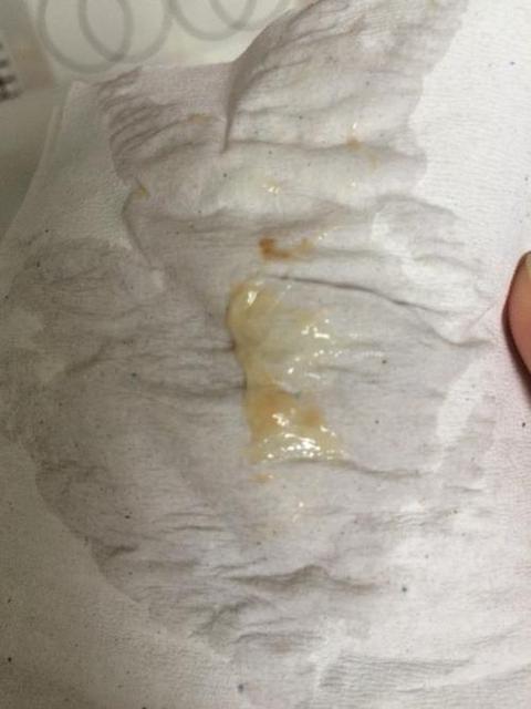 怀孕皮肤干燥发黄怎么办