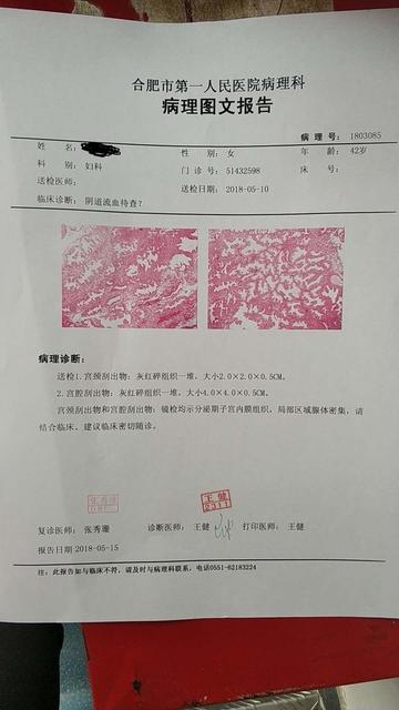 不伴不典型性子宫内膜增生症严重吗