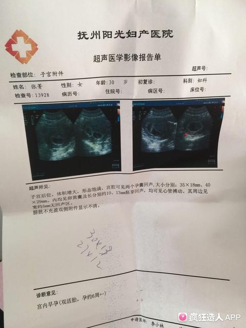 猜宝宝性别的四十五个方法