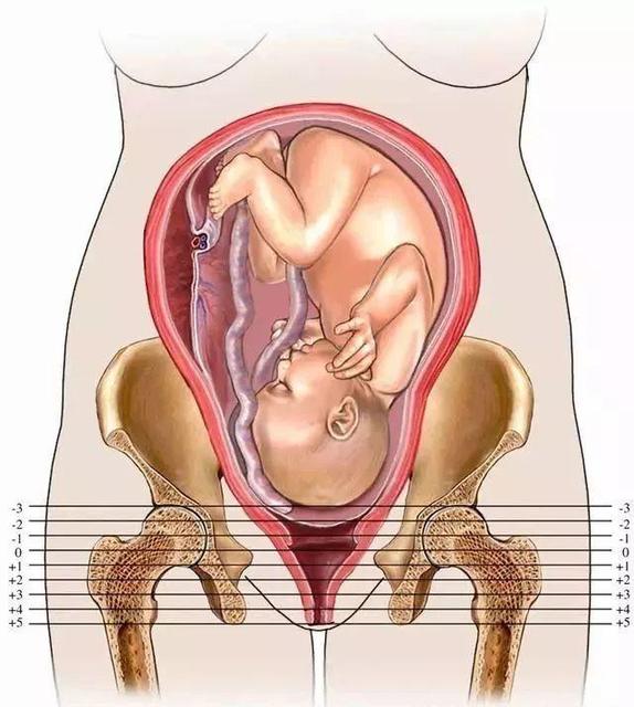 胎儿入盆自己怎么摸图解