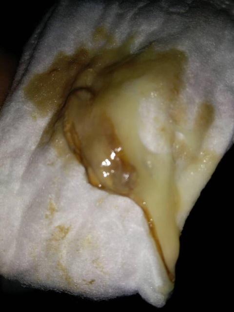 孩子手脚冰凉代表他很冷吗