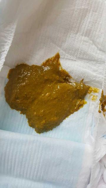 从宝宝的大便判断怎样选择奶粉