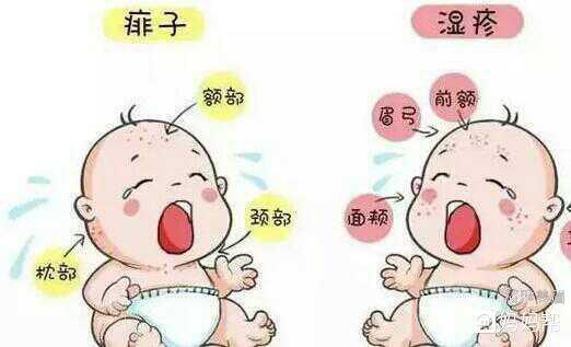 痱子和湿疹的区别