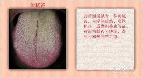 小儿口臭是什么原因