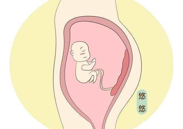 胎盘植入切除子宫概率多大