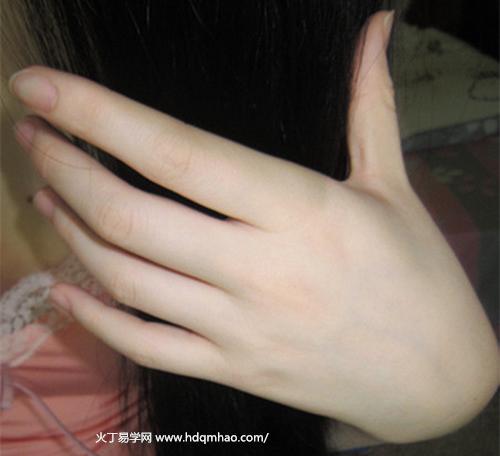 女人梦见拔牙,生活会丰裕.商人梦见拔牙,能做一笔能获大利的生意.