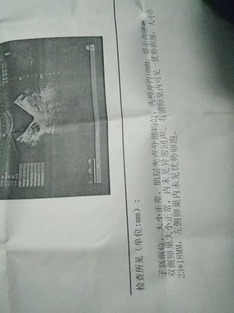多大的卵泡才算优势卵泡