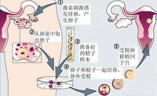试管婴儿怀孕产检流程