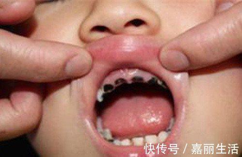 宝宝牙齿萌发最晚什么时候
