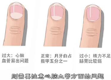 宝宝没有月牙白身体哪里出了问题