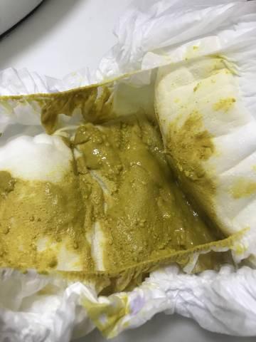 宝宝奶粉喂养的剂量表