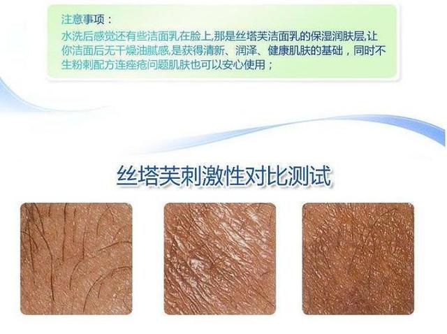 宝宝皮肤太干燥