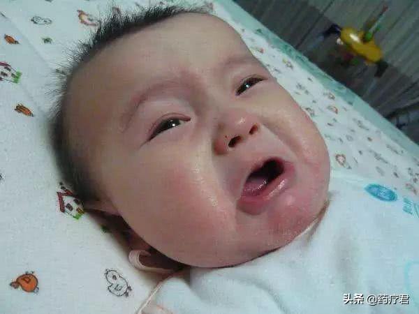 宝宝干性湿疹怎么护理